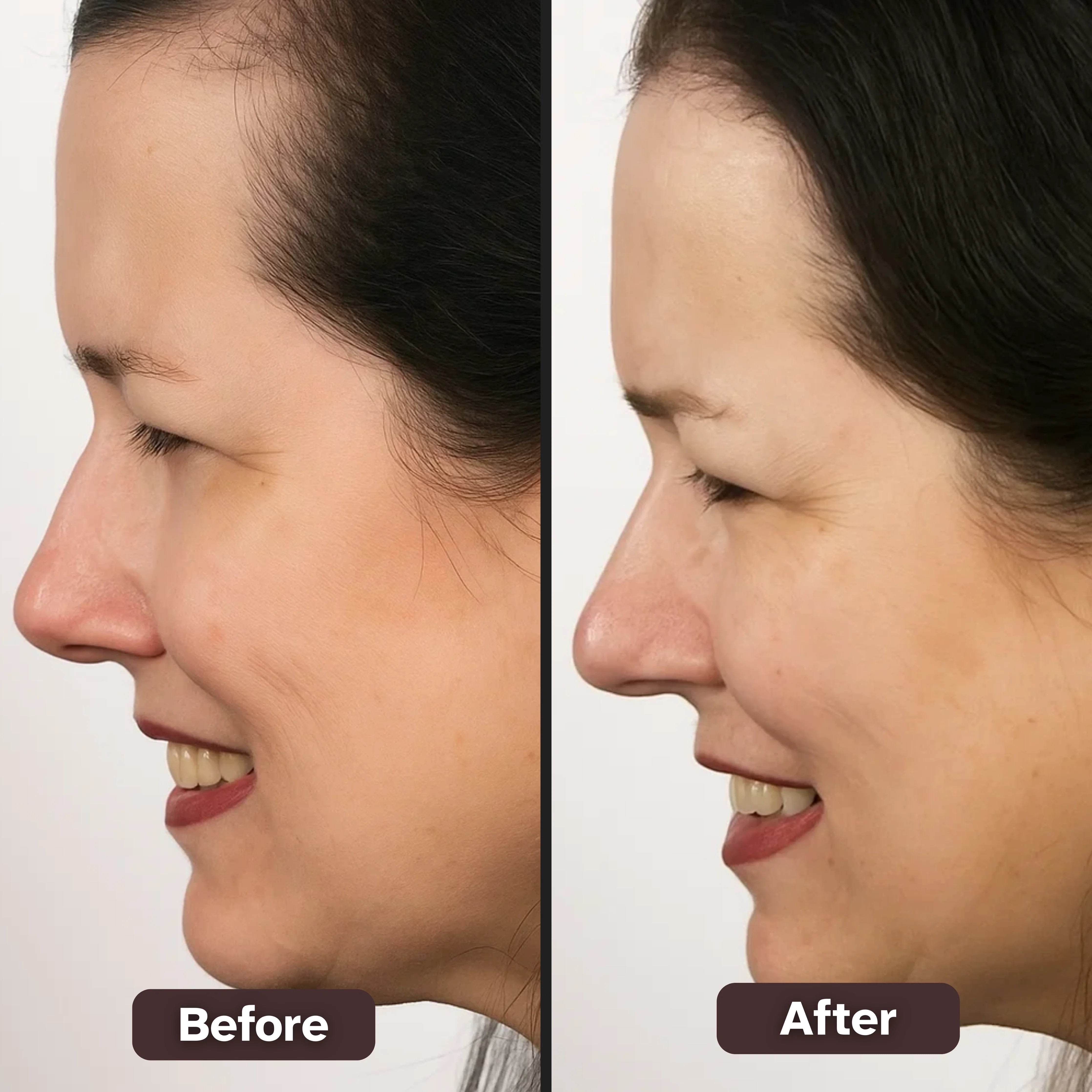 ScalpGone - Root Powder Hair Touch-Up for Coverage