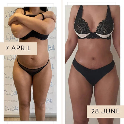 3D Compression Leggings