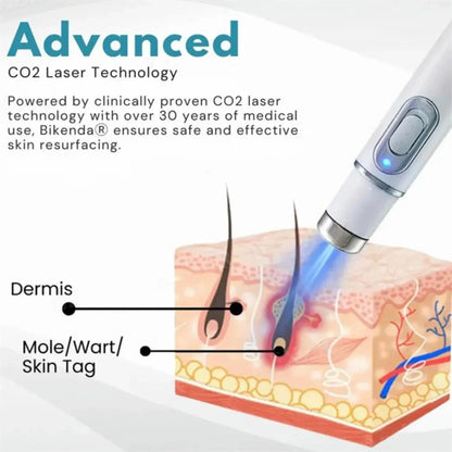 Glowzen™ – Remove Moles & Skin Tags Instantly at Home