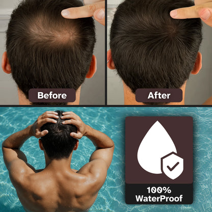 ScalpGone - Root Powder Hair Touch-Up for Coverage